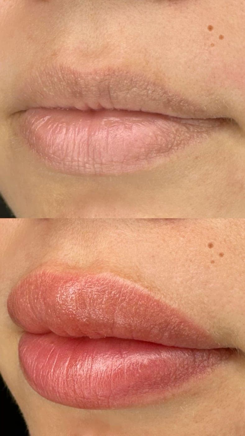 Lábios antes e depois, em tom coral