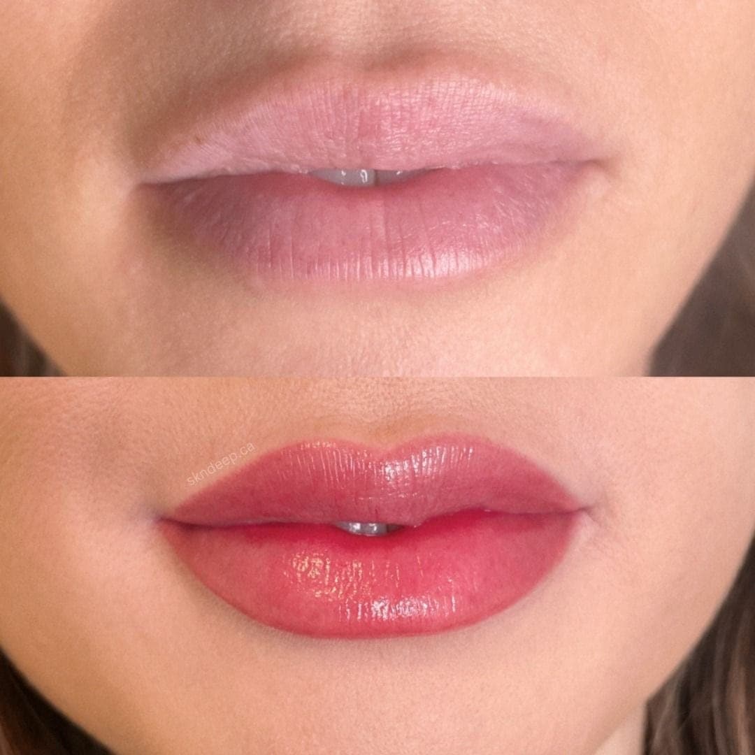 Lábios antes e depois, em tom rosa