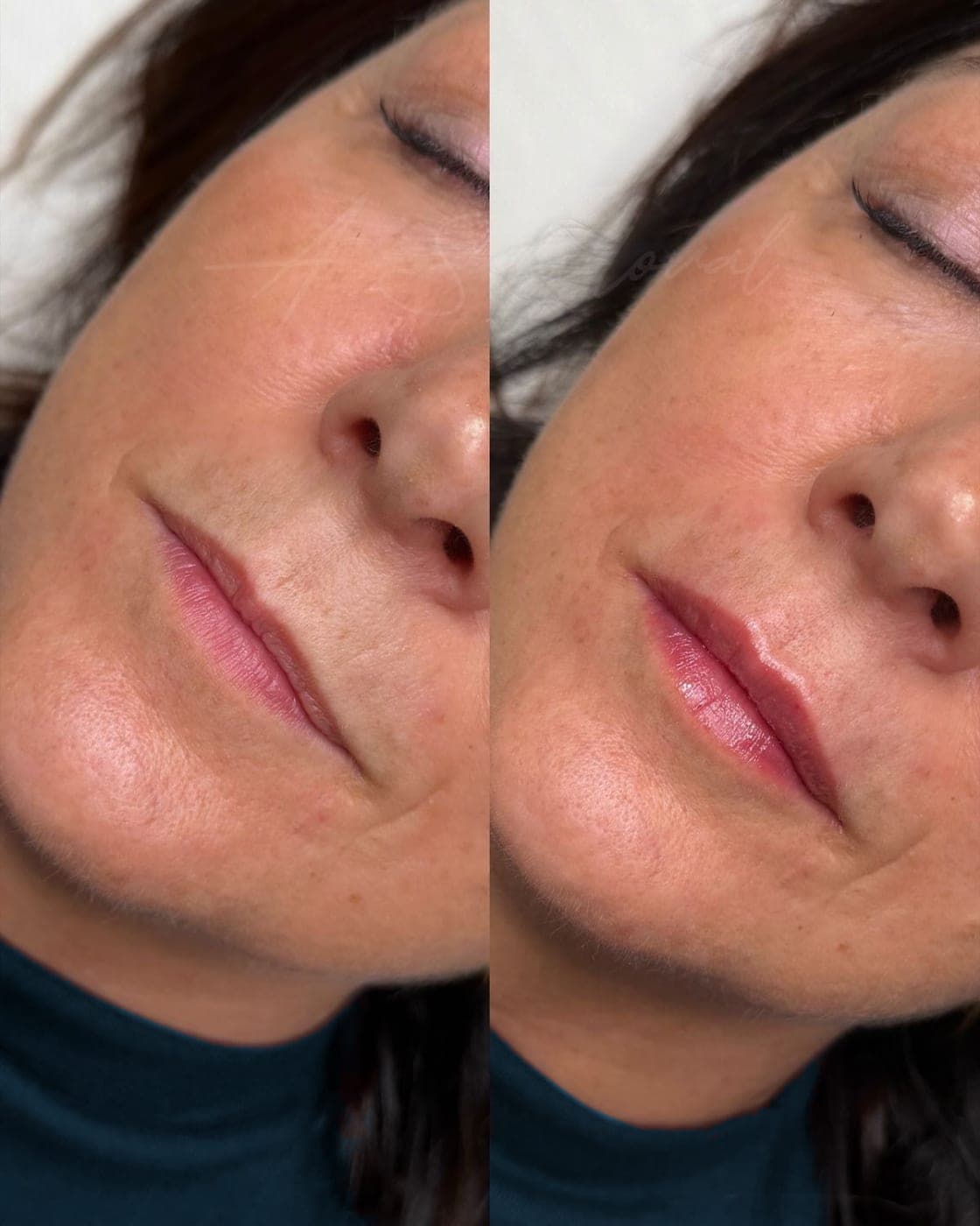 Lábios antes e depois da micropigmentação